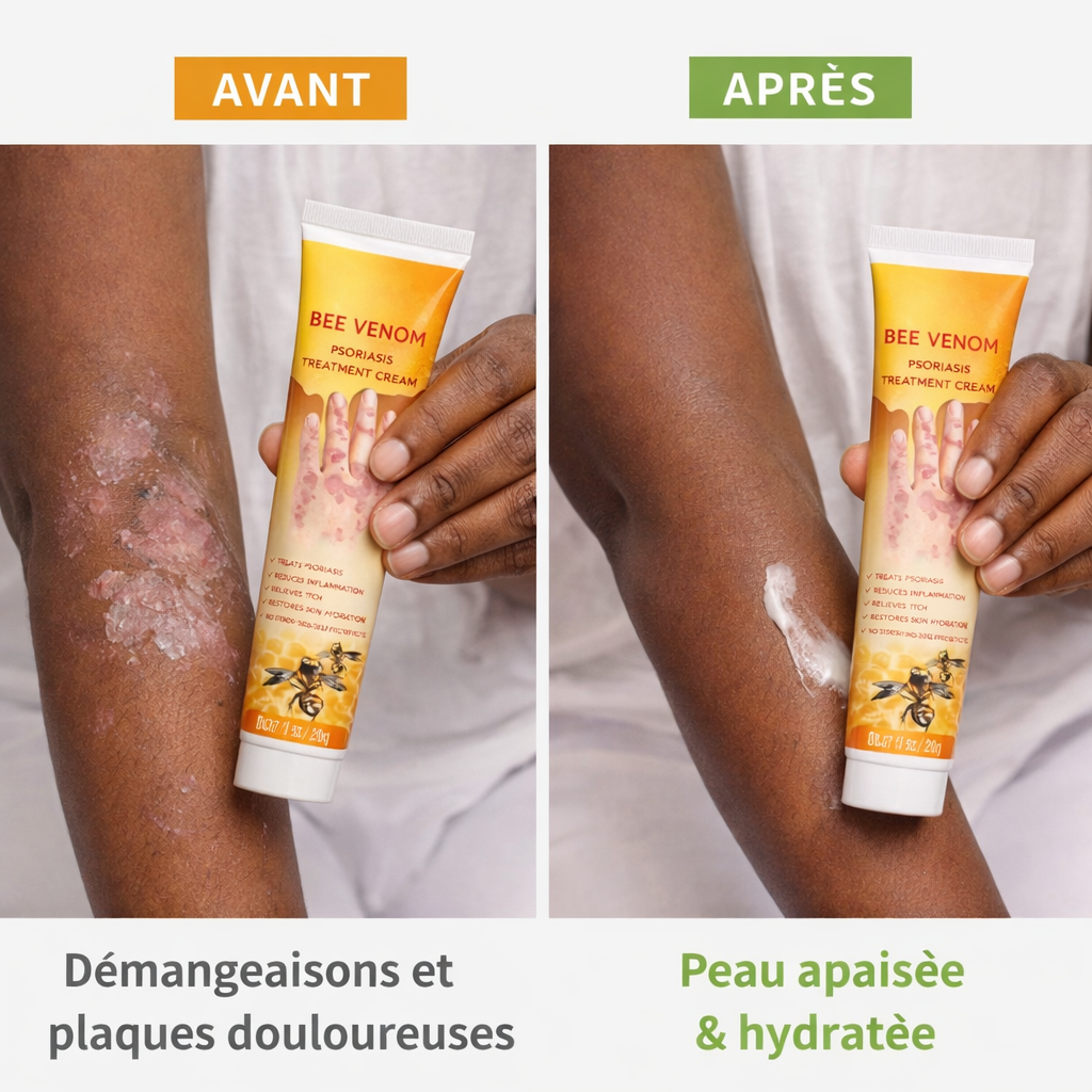 🌿 ELYNNOR CARE - Crème Apaisante & Réparatrice – Peaux Sensibles